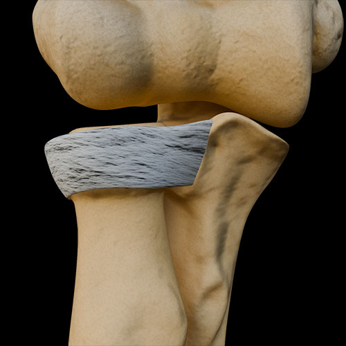 Radioulnar Joints